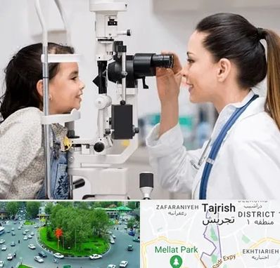 چشم پزشکی کودکان در تجریش