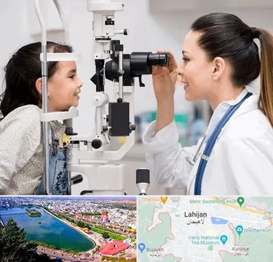 چشم پزشکی کودکان در لاهیجان