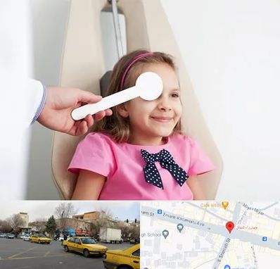 دکتر تنبلی چشم در شهناز تبریز