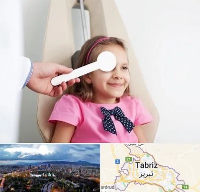 دکتر تنبلی چشم در تبریز