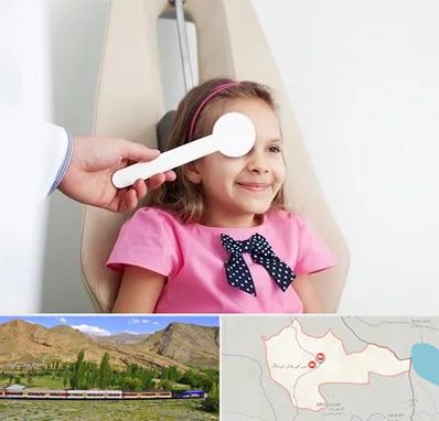 دکتر تنبلی چشم در خاش