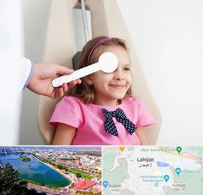 دکتر تنبلی چشم در لاهیجان