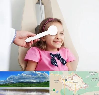 دکتر تنبلی چشم در مرند