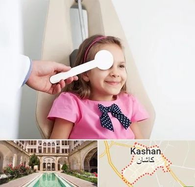 دکتر تنبلی چشم در کاشان