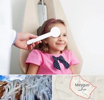 دکتر تنبلی چشم در میگون