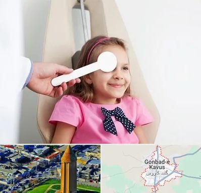 دکتر تنبلی چشم در گنبد کاووس