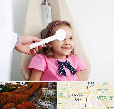 دکتر تنبلی چشم در ولیعصر