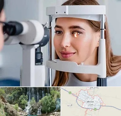 دکتر قوز قرنیه در شیروان