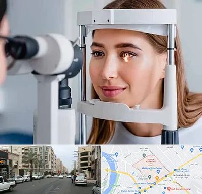 دکتر قوز قرنیه در زیتون کارمندی اهواز