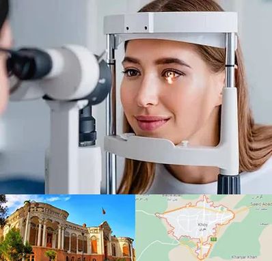 دکتر قوز قرنیه در خوی