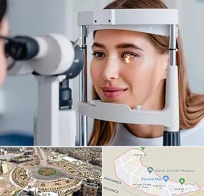 دکتر قوز قرنیه در پرند