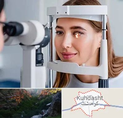 دکتر قوز قرنیه در کوهدشت