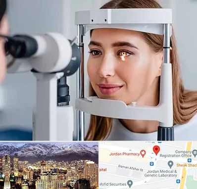 دکتر قوز قرنیه در جردن