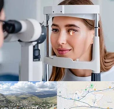 دکتر قوز قرنیه در رودهن
