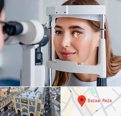 دکتر قوز قرنیه در بازار رضا مشهد