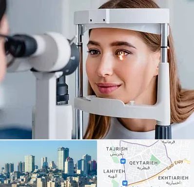 دکتر قوز قرنیه در قیطریه