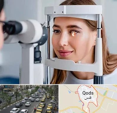 دکتر قوز قرنیه در شهر قدس