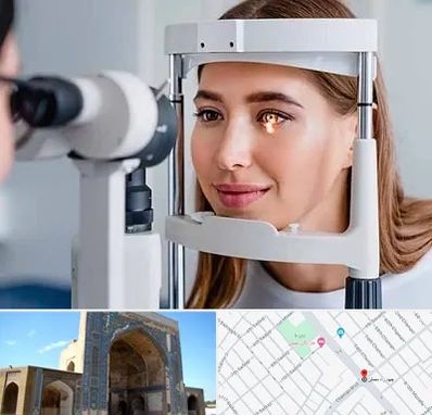 دکتر قوز قرنیه در مصلی مشهد