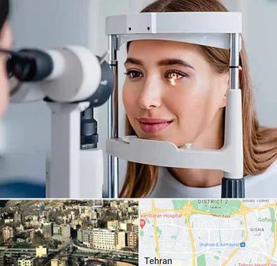 دکتر قوز قرنیه در مرزداران