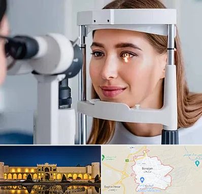 دکتر قوز قرنیه در برازجان