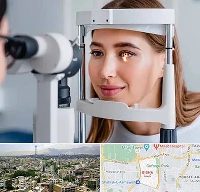 دکتر قوز قرنیه در گیشا