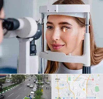 دکتر قوز قرنیه در ستارخان