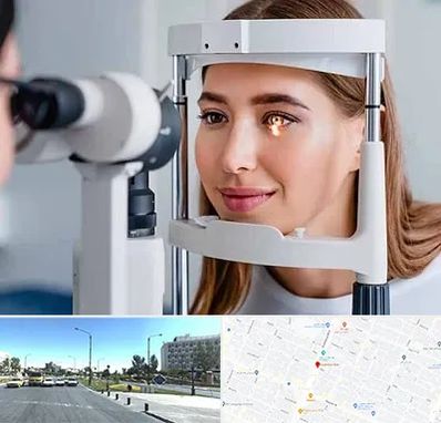 دکتر قوز قرنیه در بلوار کلاهدوز مشهد