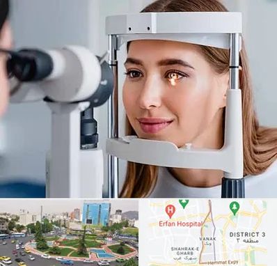 دکتر قوز قرنیه در ونک تهران