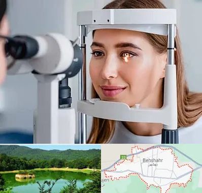 دکتر قوز قرنیه در بهشهر