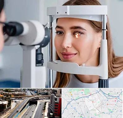 دکتر قوز قرنیه در ستارخان شیراز