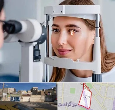 دکتر قوز قرنیه در اتابک