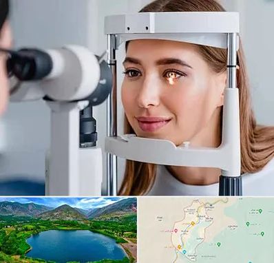 دکتر قوز قرنیه در رودبار