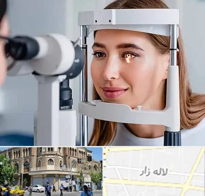 دکتر قوز قرنیه در لاله زار