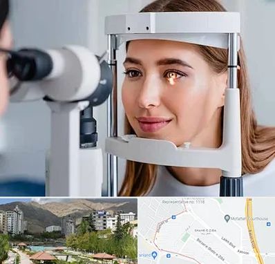 دکتر قوز قرنیه در شهر زیبا