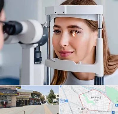 دکتر قوز قرنیه در پرواز تبریز