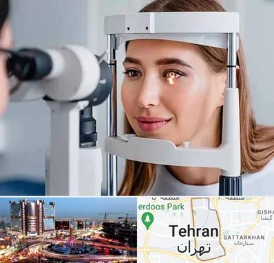 دکتر قوز قرنیه در صادقیه تهران