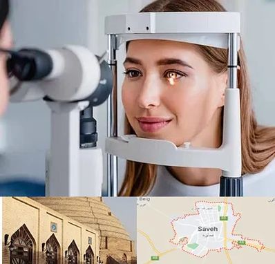 دکتر قوز قرنیه در ساوه