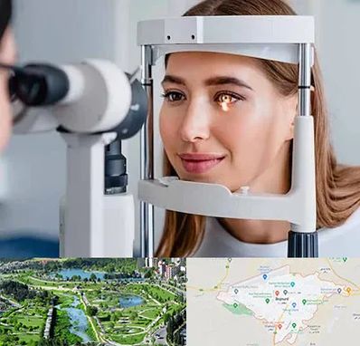 دکتر قوز قرنیه در بجنورد