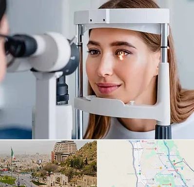 دکتر قوز قرنیه در فرهنگ شهر شیراز