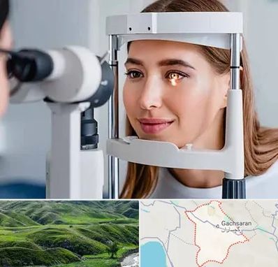 دکتر قوز قرنیه در گچساران