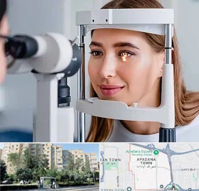 دکتر قوز قرنیه در آپادانا