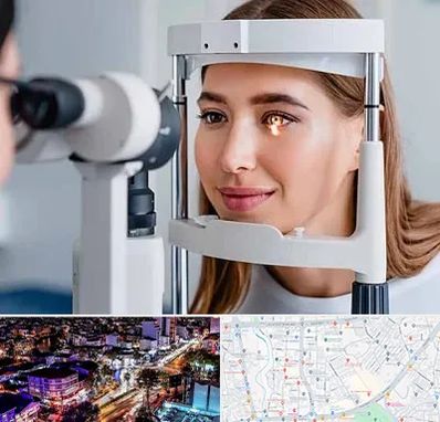 دکتر قوز قرنیه در منظریه رشت