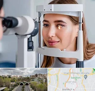 دکتر قوز قرنیه در یوسف آباد