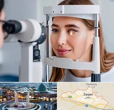 دکتر قوز قرنیه در زنجان