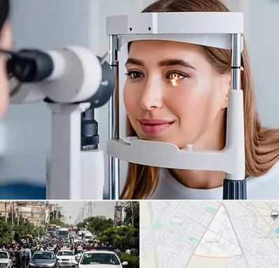 دکتر قوز قرنیه در سیدی مشهد