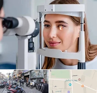 دکتر قوز قرنیه در چهارراه استانبول