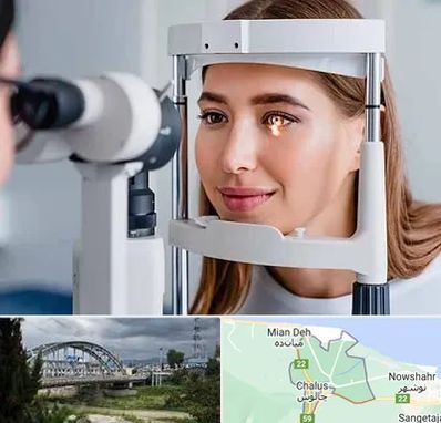 دکتر قوز قرنیه در چالوس