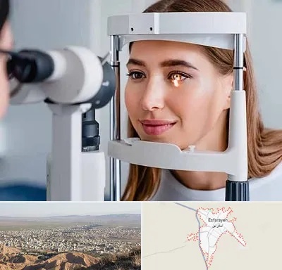 دکتر قوز قرنیه در اسفراین