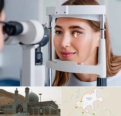 دکتر قوز قرنیه در شهرضا