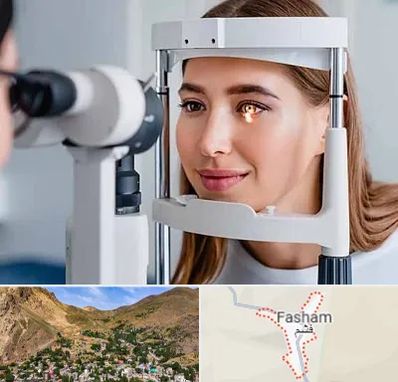 دکتر قوز قرنیه در فشم